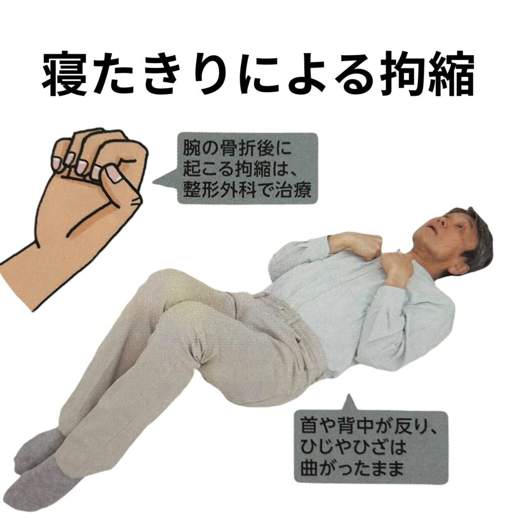 写真でわかる拘縮ケアp11